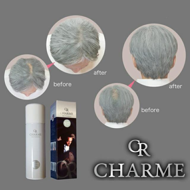 アンドレ様専用フォンテーヌ ヘアピース 医療用（自然に見える
