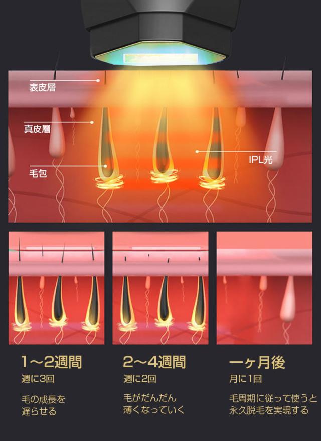 脱毛器 IPL光脱毛器 vio 99万回照射 冷却クーリング機能 美肌ケア