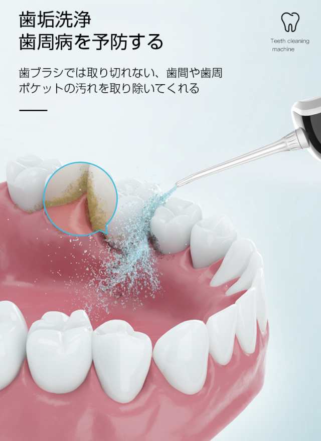 口腔洗浄機 ウォーターピック ジェットウォッシャー 歯垢除去 USB充電式