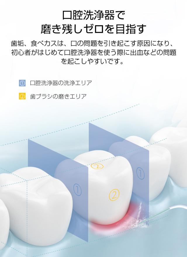 2025年新モデル 口腔洗浄器 ウォーターピック ジェットウォッシャー 電動ウォッシャー はみがき補助 電動 音波歯ブラシ 携帯 コンパクト 手軽なハンディタイプ 280ml水タンク コードレス 歯周ポケット洗浄 歯ぐき健康 歯垢除去 磨き残しゼロ 【PL保険加入済み製品・安心】_3