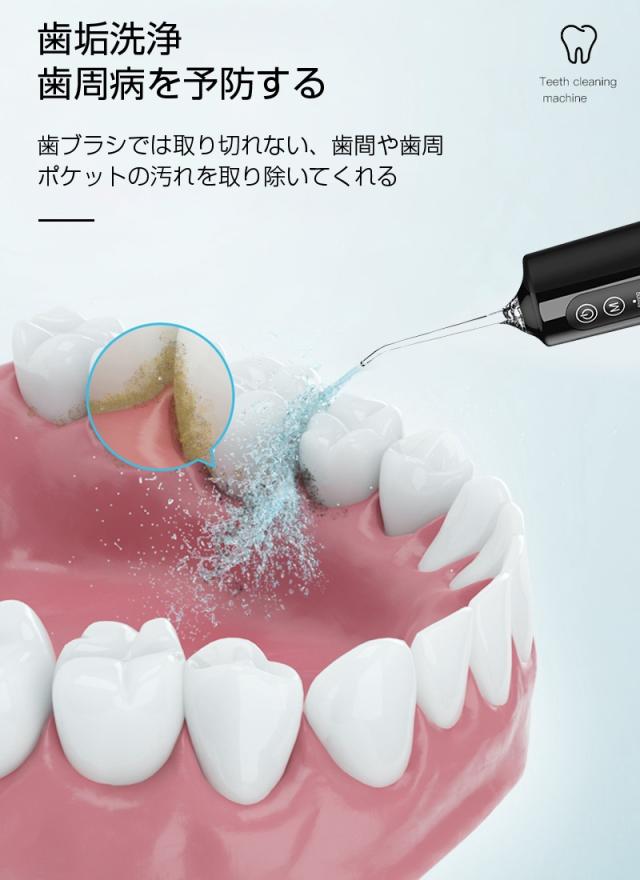 2025年新モデル 口腔洗浄器 ウォーターピック ジェットウォッシャー 電動ウォッシャー はみがき補助 電動 音波歯ブラシ 携帯 コンパクト 手軽なハンディタイプ 280ml水タンク コードレス 歯周ポケット洗浄 歯ぐき健康 歯垢除去 磨き残しゼロ 【PL保険加入済み製品・安心】_4
