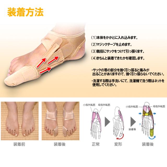 (外反母趾サポーター)(日本製)坂本接骨院 ぼっち君 (BOCHIKUN) 左右セット x1個 (S・M・Lの3サイズから選択) - ボッチ君・ぼっちくん・ボッチくん。親指の形状に応じて自由に調整が可能なのはぼっち君だけ。の通販は (外反母趾サポーター)(日本製)坂本接骨院 ぼっち君 (BOCHIKUN) 左右セット x1個 (S・M・Lの3サイズから選択) - ボッチ君・ぼっちくん・ボッチくん。親指の形状に応じて自由に調整が可能なのはぼっち君だけ。の通販は