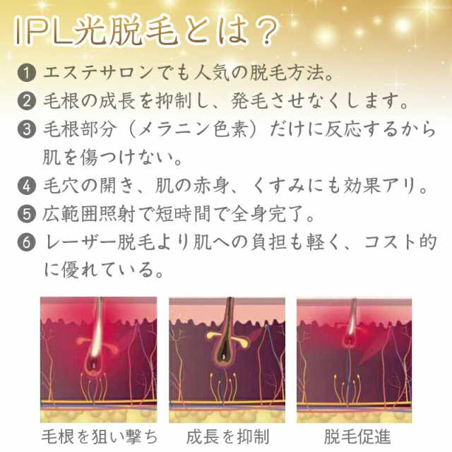 剛毛にも 出力36W強力！！ IPL光脱毛器 永久脱毛 40万発 5段階