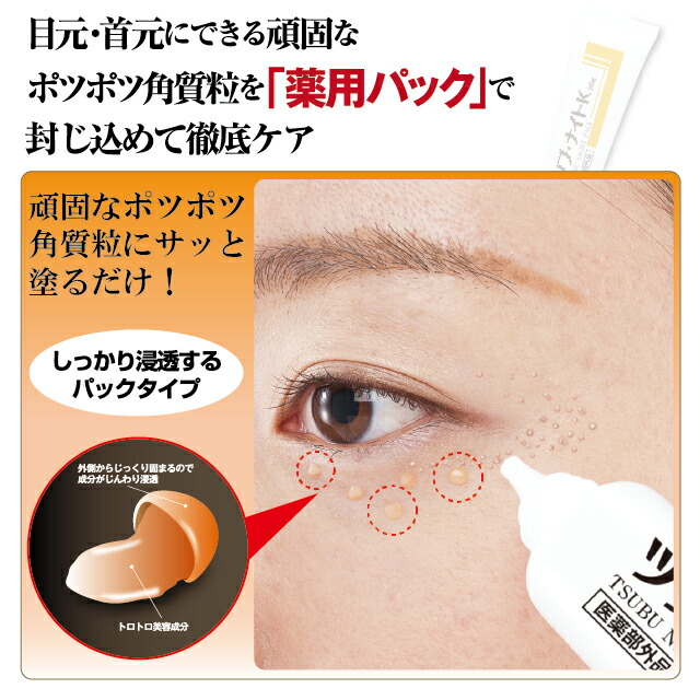 薬用ツブ・ナイトK 医薬部外品 30g （３個セット） シェモア 角質 薬用パック 美肌 毛穴対策 ダメージお肌に イボ対策 化粧品 効果効能 パック クリーム スキンケア 目元 ポツポツ 首元 送料無料_1