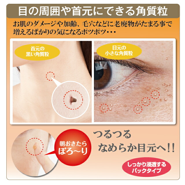 薬用ツブ・ナイトK 医薬部外品 30g （３個セット） シェモア 角質 薬用パック 美肌 毛穴対策 ダメージお肌に イボ対策 化粧品 効果効能 パック クリーム スキンケア 目元 ポツポツ 首元 送料無料_2