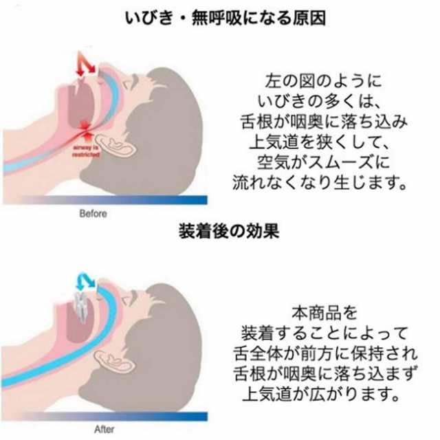 舌用マウスピース 鼻呼吸 いびき防止 グッズ 快眠 いびき 舌 マウスピース 送料無料の通販はau PAY マーケット - ライフハンサー | au  PAY マーケット－通販サイト