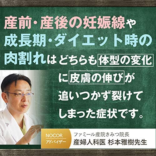2ヶ月集中ケア 産後の妊娠線や頑固な肉割れに Nocor ノコア 浸透ケアセット クリーム ヒートブースターボディマッサージ Vcオイル の通販はau Pay マーケット Nocorノコア公式ストア Au Pay マーケット店