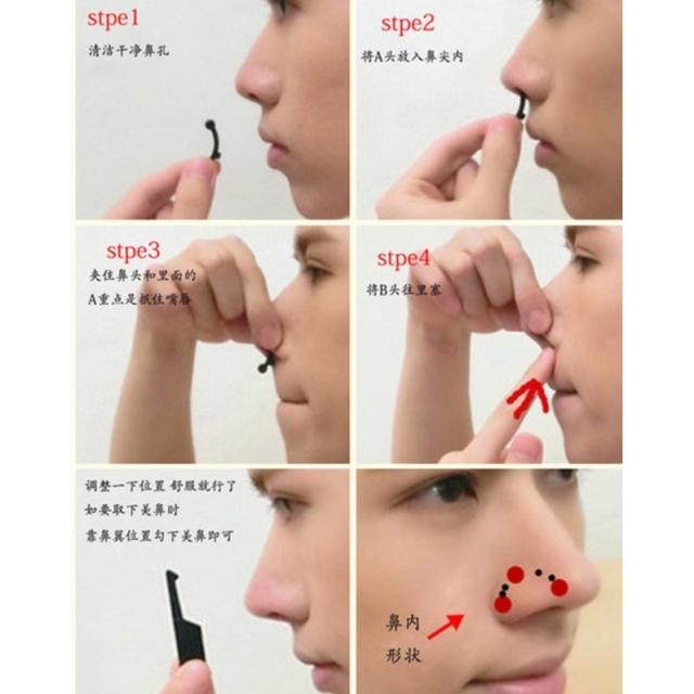 鼻プチ ぺちゃんこ鼻の矯正 整形不要 団子鼻や豚鼻やぺちゃんこ鼻の矯正に S M Lと3サイズセットの通販はau Pay マーケット T Tortue Shop