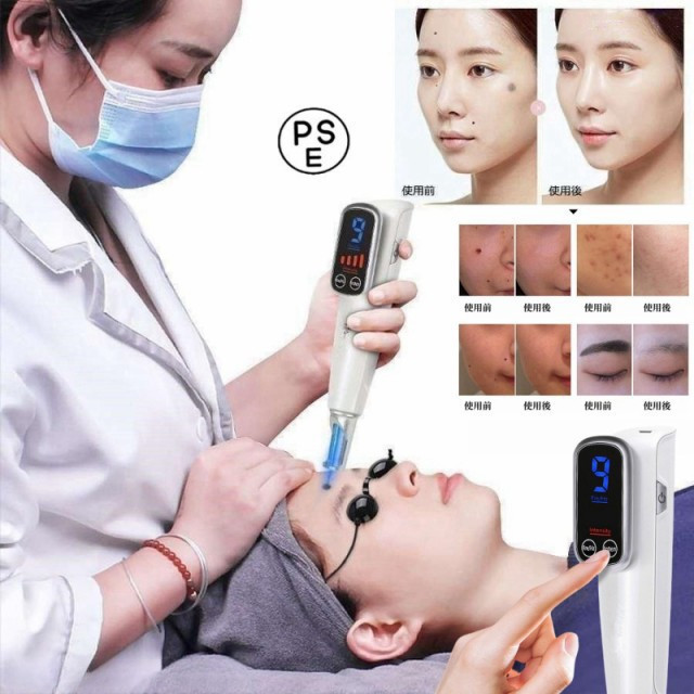 美顔器 ピコレーザー 美顔器 ほくろそばかす除去 シミ 斑 青色レーザー