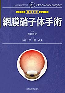 網膜硝子体手術 (イラスト眼科手術シリーズ 6)(中古品)の通販は