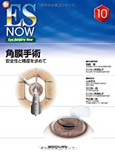 角膜手術?安全性と精度を求めて (新ES NOW 10)(中古品)の通販は