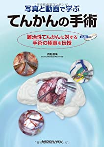 写真と動画で学ぶ てんかんの手術 [DVD付](中古品)の通販は