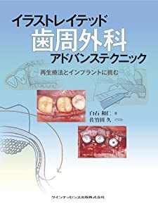 イラストレイテッド 歯周外科アドバンステクニック(中古品)の イラストレイテッド 歯周外科アドバンステクニック(中古品)の