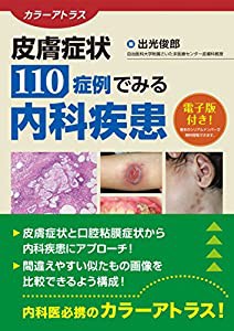 カラーアトラス 皮膚症状110症例でみる内科疾患【電子版付き】(中古品)の通販は