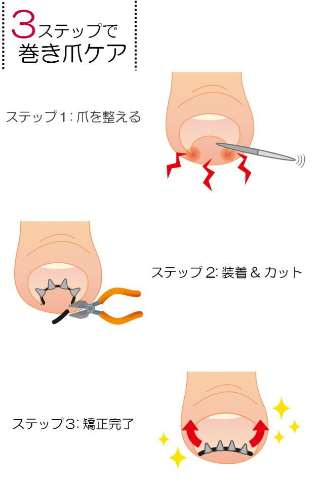 まきづめリフト 専用ヤスリ付き×2個セット | まきづめリフト 専用ヤスリ付き×2個セット | まきづめリフト