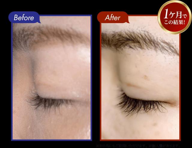【新品】CIL SERUM ヒト幹細胞まつ毛まゆ毛美容液 楽天市場】＼ポイント5倍 8/4 20:00〜8/11 1:59限定／ 特許成分