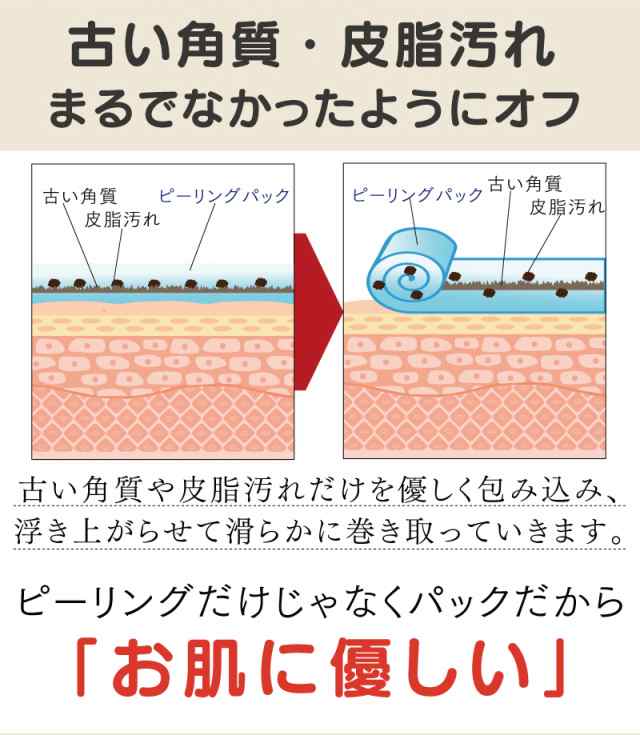 ホワイトボディピーリングパック 医薬部外品 黒ずみ 美白 角質 皮脂