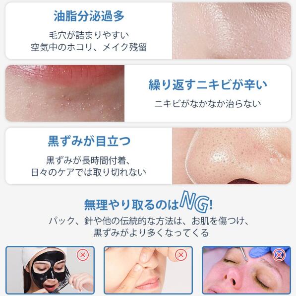 22年最新 毛穴吸引器 毛穴ケア 美顔器 毛穴洗浄 毛穴クリーン 角栓除去 黒ずみ 毛穴汚れ 保湿 イチゴ鼻吸引 彼女 メンズ 口コミ 美肌 の通販はau Pay マーケット Supermarket Au Pay マーケット店 22年最新 毛穴吸引器 毛穴ケア 美顔器 毛穴洗浄 毛穴クリーン 角栓除去 黒ずみ 毛穴汚れ 保湿 イチゴ鼻吸引 彼女 メンズ 口コミ 美肌 の通販はau Pay マーケット Supermarket Au Pay マーケット店