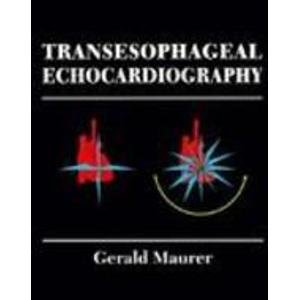 Transesophageal Echocardiography(中古品) 25,050円