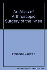 An Atlas of Arthroscopic Surgery of the Knee(中古品)