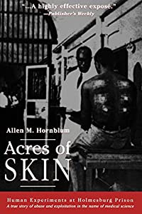 Acres of Skin(中古品)の通販は 6,290円