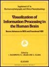 Visualization of Information Processing in the Human Brain - Recent Advances in Meg and Functional Mri (Eeg Supplement S