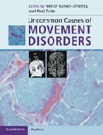 Uncommon Causes of Movement Disorders(中古品)