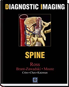 Diagnostic Imaging: Spine(中古品)