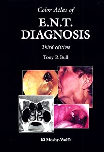 Color Atlas of Ent Diagnosis(中古品)