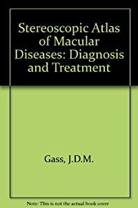 Stereoscopic Atlas of Macular Diseases: Diagnosis and Treatment(中古品)