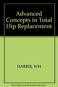 Advanced Concepts in Total Hip Replacement(中古品)