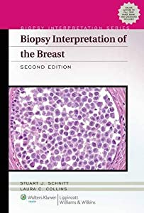 Biopsy Interpretation of the Breast (Biopsy Interpretation Series)(中古品)