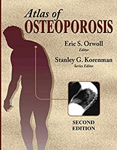 Atlas of Osteoporosis(中古品)