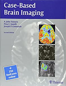 Case-Based Brain Imaging(中古品)