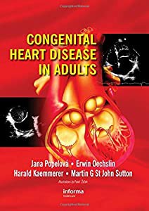 Congenital Heart Disease in Adults(中古品)