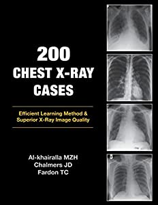 200 Chest X-Ray Cases(中古品)