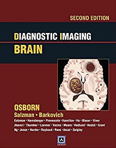 Diagnostic Imaging: Brain(中古品)の通販は