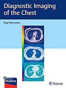 Diagnostic Imaging of the Chest(中古品)
