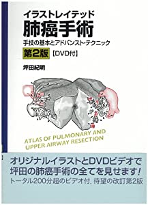 イラストレイテッド肺癌手術[DVD付]—手技の基本とアドバンスト・テクニック(中古品)