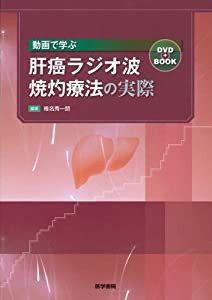 動画で学ぶ肝癌ラジオ波焼灼療法の実際 DVD+BOOK(中古品)の通販は