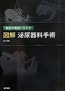 解剖を実践に生かす　図解 泌尿器科手術(中古品)の通販は 15,289円