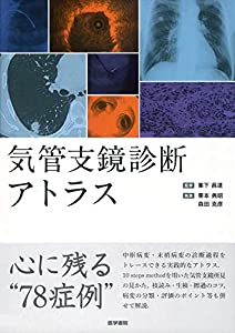 気管支鏡診断アトラス(中古品)の通販は