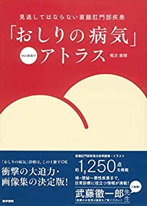 「おしりの病気」アトラス　[Web動画付](中古品)