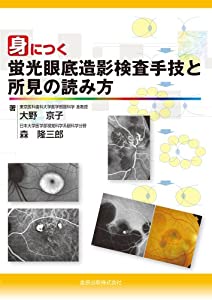 身につく蛍光眼底造影検査手技と所見の読み方(中古品)