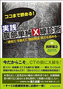 ココまで読める! 当て嵌める土手っ腹飾り気の無いX線読み合わせる(中古品)