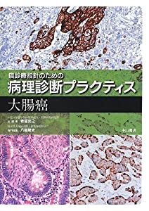 大腸癌 (癌診療指針のための病理診断プラクティス)(中古品)