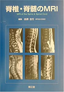 脊椎・脊髄のMRI(中古品)
