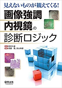 見えないものが観えてくる! 画像強調内視鏡の診断ロジック(中古品)