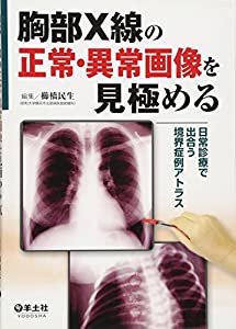 乳ぶさX線の規則正しい・人並み外れたすがた絵を見極める—日常で出合う境界線症例アトラス(中古品)