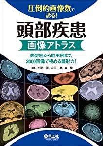 圧倒的画像数で診る! 頭部疾患画像アトラス?典型例から応用例まで、2000画像で極める読影力!(中古品)